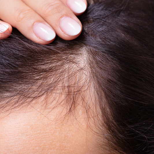 Understanding The Causes of Hair Loss and Finding Natural Solutions